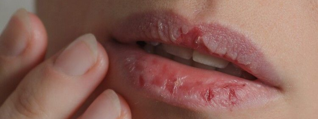Why Your Lip Balm Isn’t Working: Is It the Formula or Your Lip Care Habits?